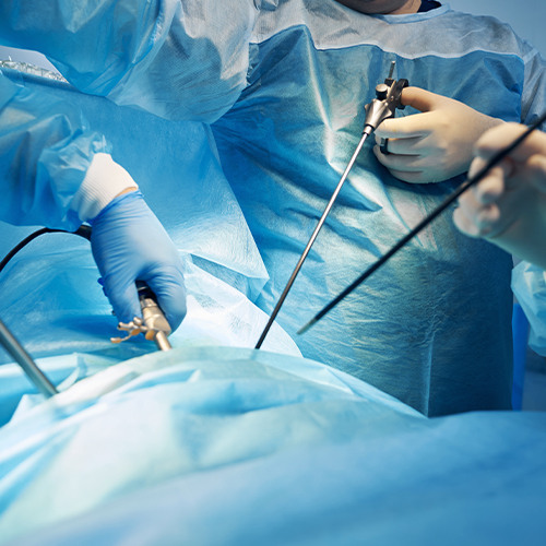 General and Laparoscopic Surgery